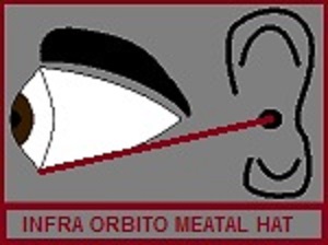 Infra Orbito Meatal Hat