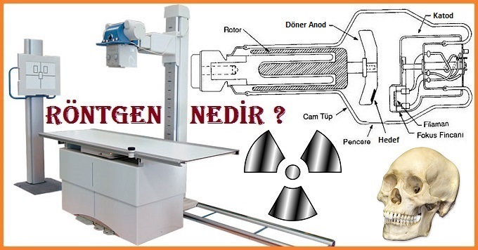 Röntgen Nedir ?