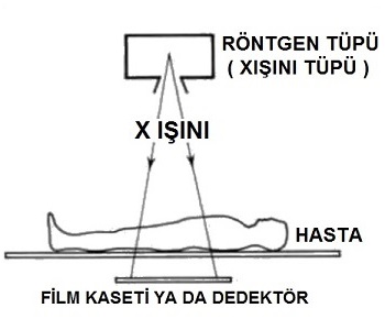 Röntgen Görüntüsü Nasıl Elde Edilir