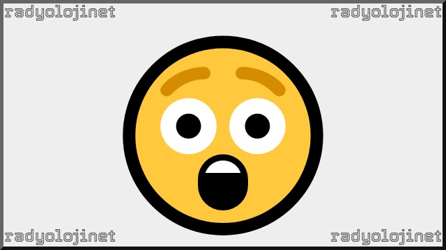 Şaşkın Yüz Emoji