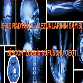 İşsiz Radyoloji Mezunlarının Sayısı Birçok İlçenin Nüfusunu Geçti | Atama Bekleyen Radyoloji Teknikerleri | Radyoloji Atama Bekliyor