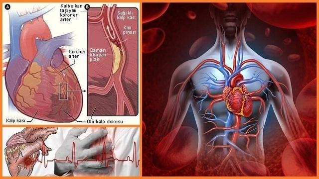 Kalp Krizi