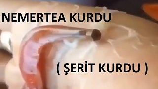 Nemertea Kurdu ( Şerit Kurdu )